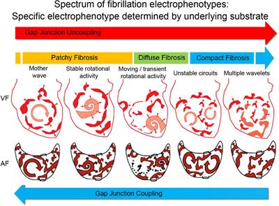 Toward Mechanism-Directed Electrophenotype-Based Treatments for Atrial Fibrillation